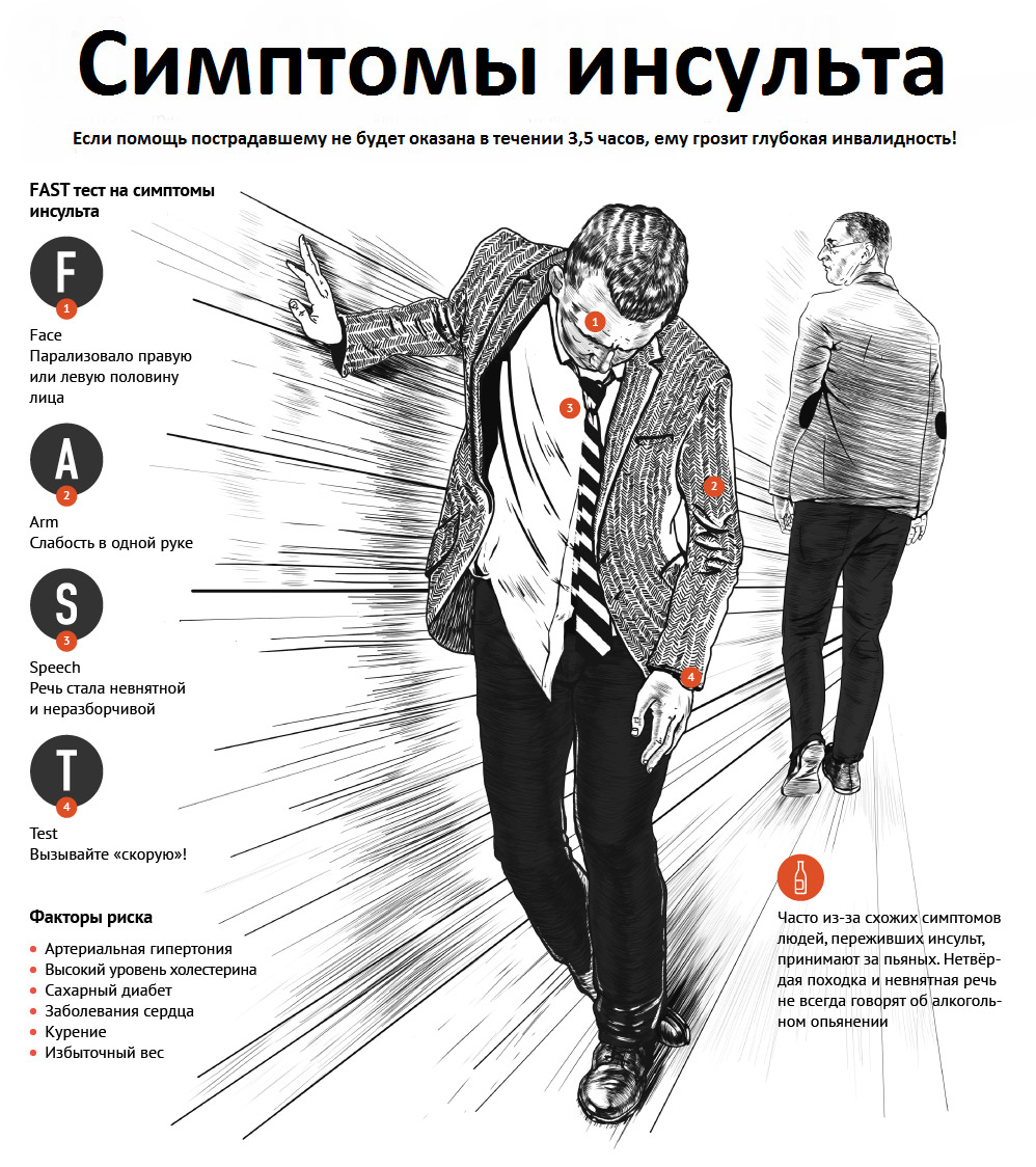 Как выглядит микроинсульт у человека